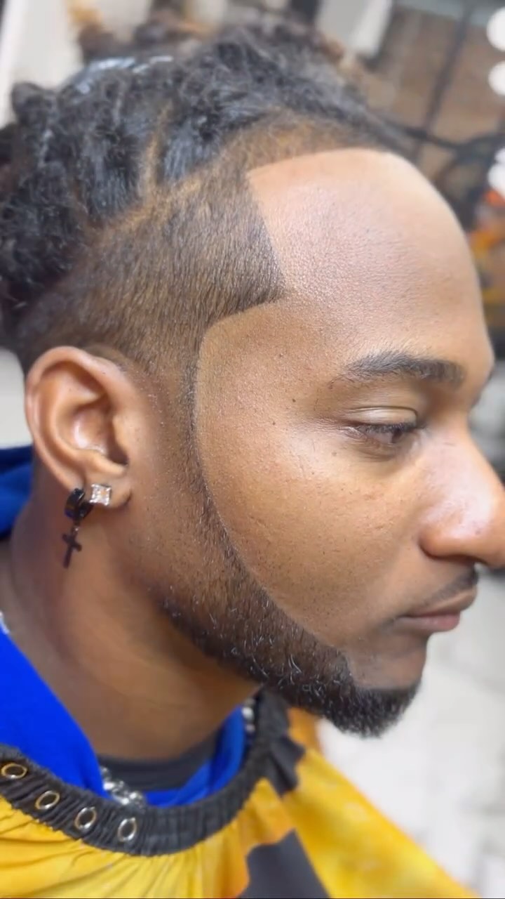 Beard and hairline enhancement